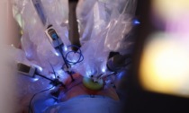 La Lombardia investe sulla chirurgia robotica, presto un centro in ogni provincia