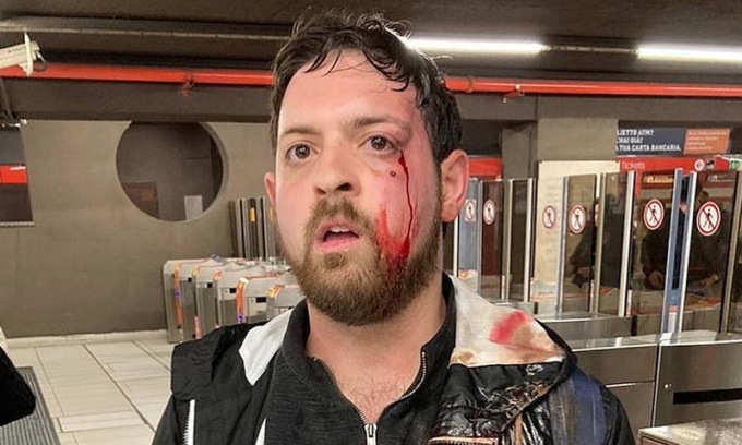“Preso a pugni perché filmavo le borseggiatrici in metro. Chi fermerà queste criminali?”