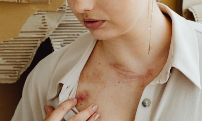 Violenza di genere, 1629 richieste d’aiuto in sei mesi ai centri antiviolenza di Milano