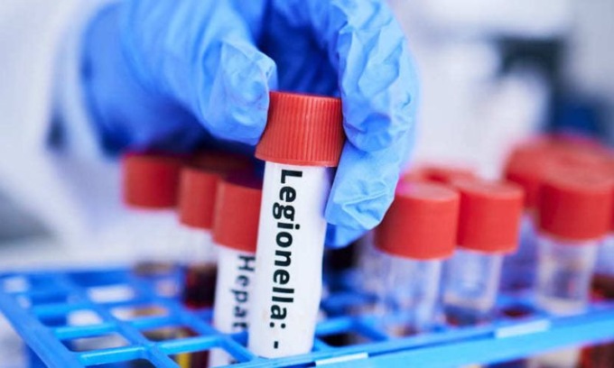 Nuovi casi di legionella nel sudovest milanese, Negri (Pd): “Ats Milano deve alzare la guardia”