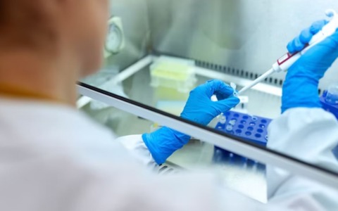 Allarme Legionella in zona San Siro: 11 contagiati, un deceduto e 8 ricoverati per sospetto focolaio