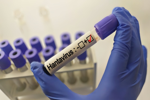 Hantavirus, turista britannico in quarantena al Sacco: negativo ai test